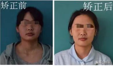 辛芷蕾是苦相女生吗,辛芷蕾气质怎么养成