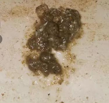 肉鸡呼吸道久治不愈,肉鸡拉稀怎么治疗最好