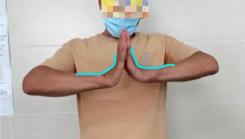 腕关节针刀松解术视频,腕关节松解术