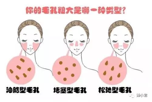 女性毛孔粗大如何护肤,毛孔粗大反复起痘怎么护肤补水