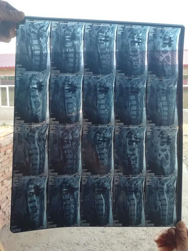 姐夫把小舅子车撞了一下怎么办,小姨子开车撞姐夫保险赔吗