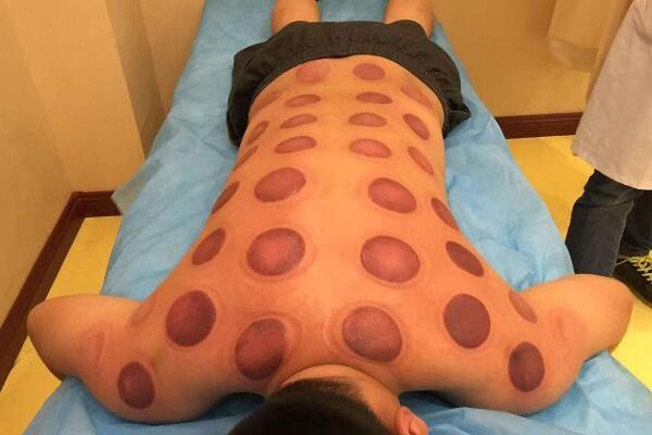 「辽阳小百科」体内湿气重怎么办？4个调理法帮你祛除湿气