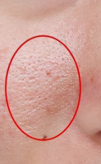 脸部清洁大概要多少钱,如何深层的脸部清洁