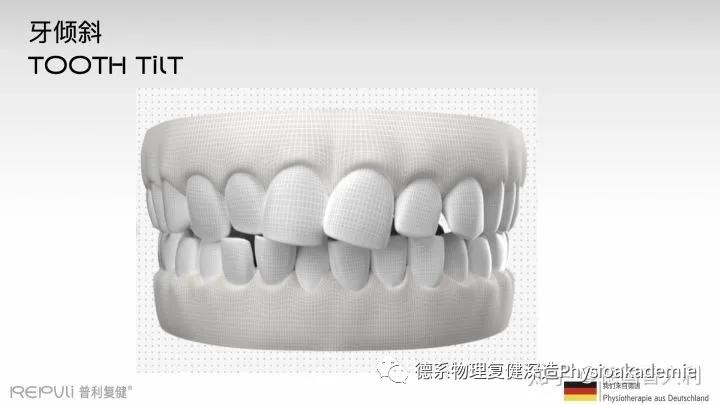颞下颌关节紊乱综合征,颞下颌关节紊乱主要检查什么项目