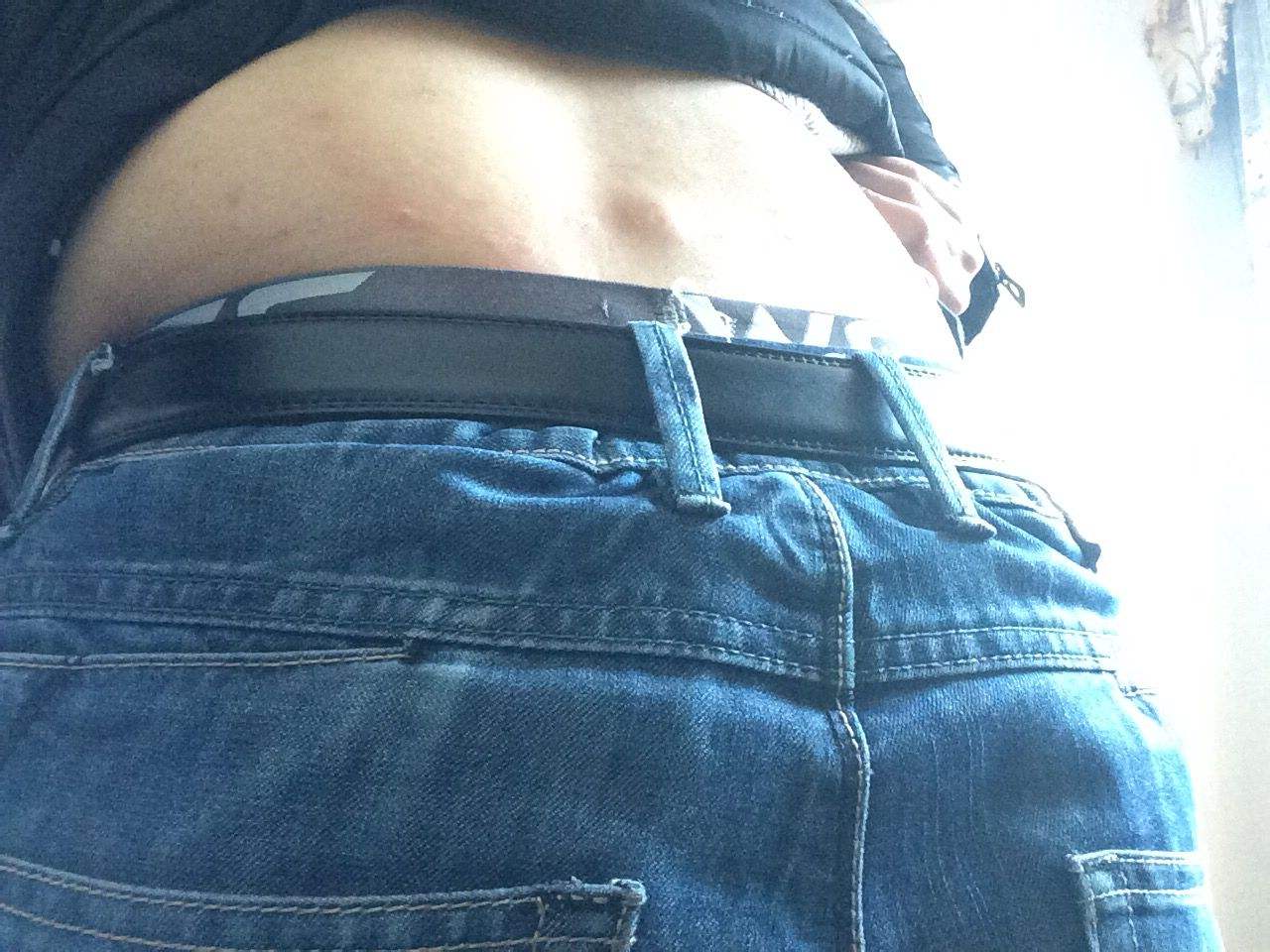 身上长了脂肪瘤要不要手术切了,身上长脂肪瘤是否需要手术治疗