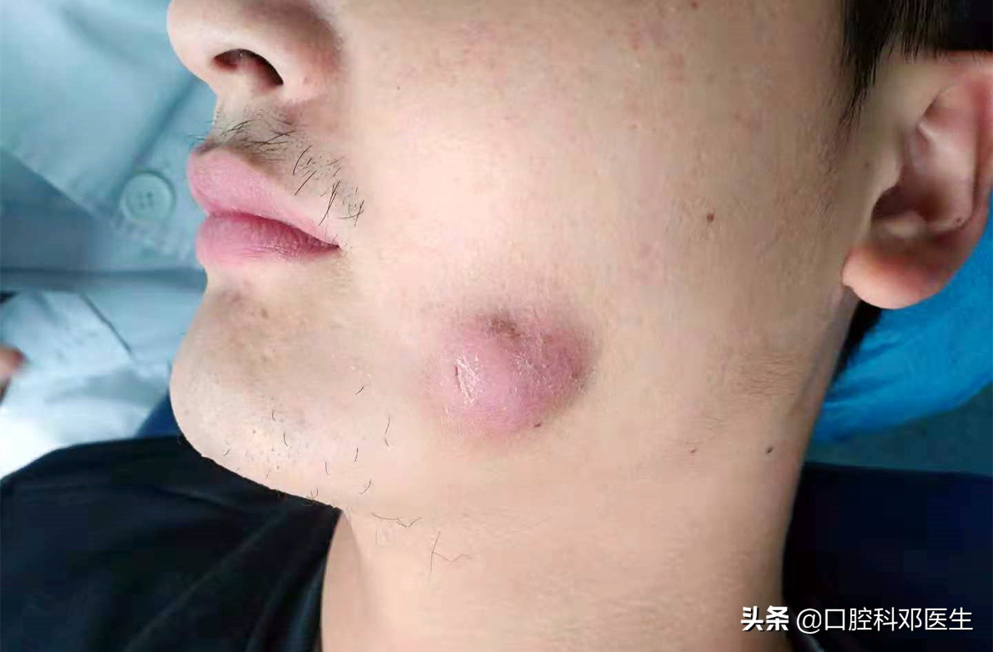 别让一张嘴毁了整张脸,别让一颗牙齿毁了一张脸