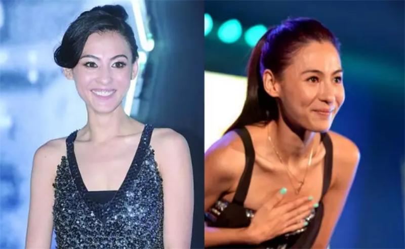 颧骨高导致脸型难看怎么办,脸型偏瘦颧骨明显怎么办改善