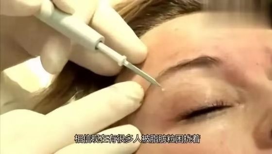 有脂肪粒用哪款眼霜好,长脂肪粒推荐哪款眼霜