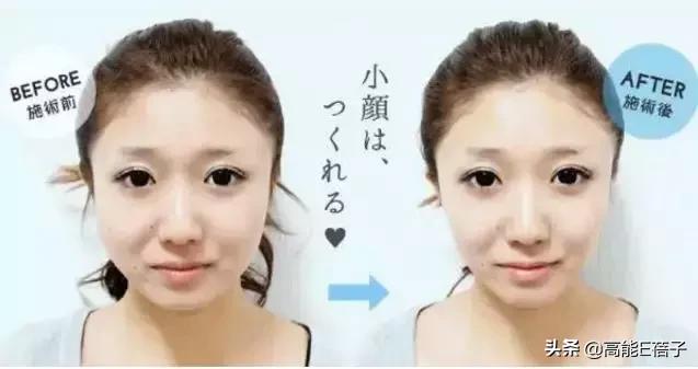 脸大真的不如脸小的好看吗,脸小真的显瘦吗