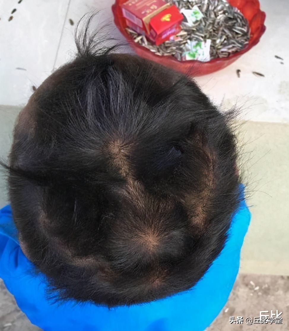 人头发后面都有个旋吗,人头上有几个旋