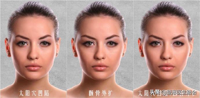 颧骨大小不对称怎么磨骨,如何分辨颧骨是高还是低