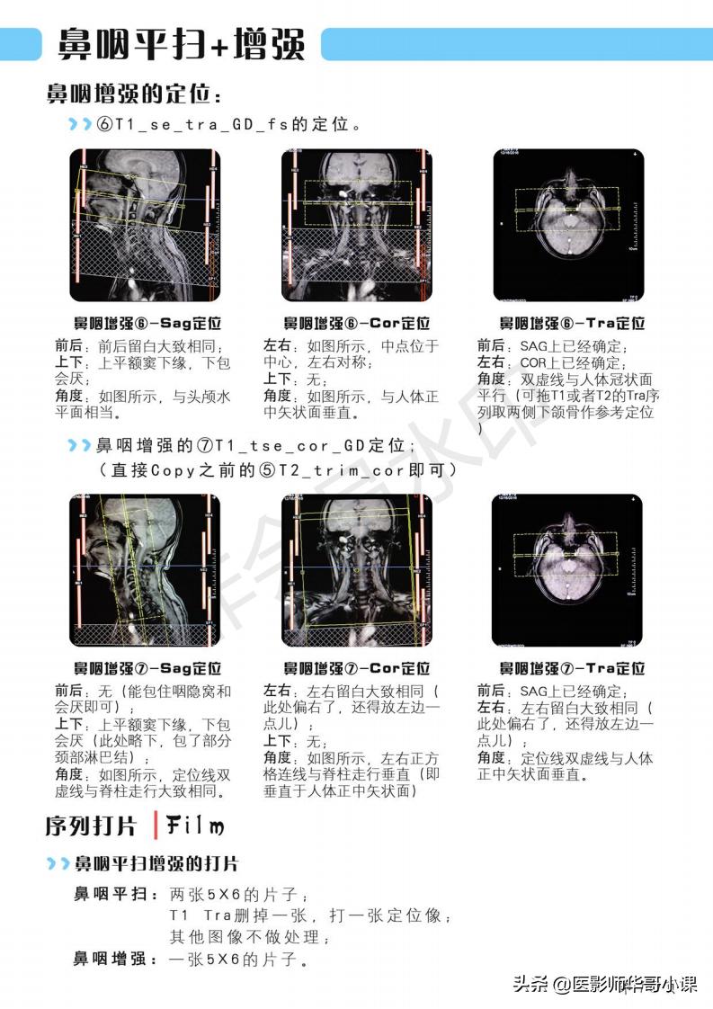 磁共振扫描技术西门子,西门子磁共振最新操作界面