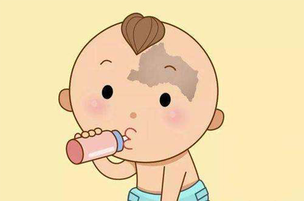 太田痣为什么不能彻底根治,太田痣怎样算是彻底治愈