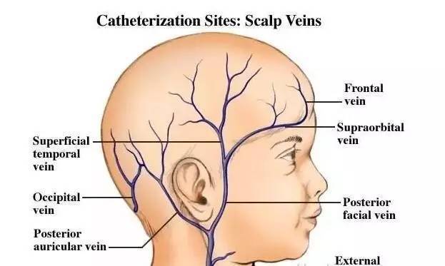 儿科留置针规范使用与维护,宝宝留置针如何保护