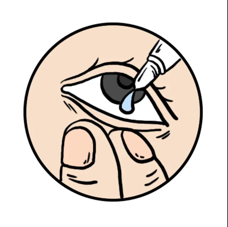 近视晶体植入手术的危害和后遗症,激光近视手术后遗症有哪些危害