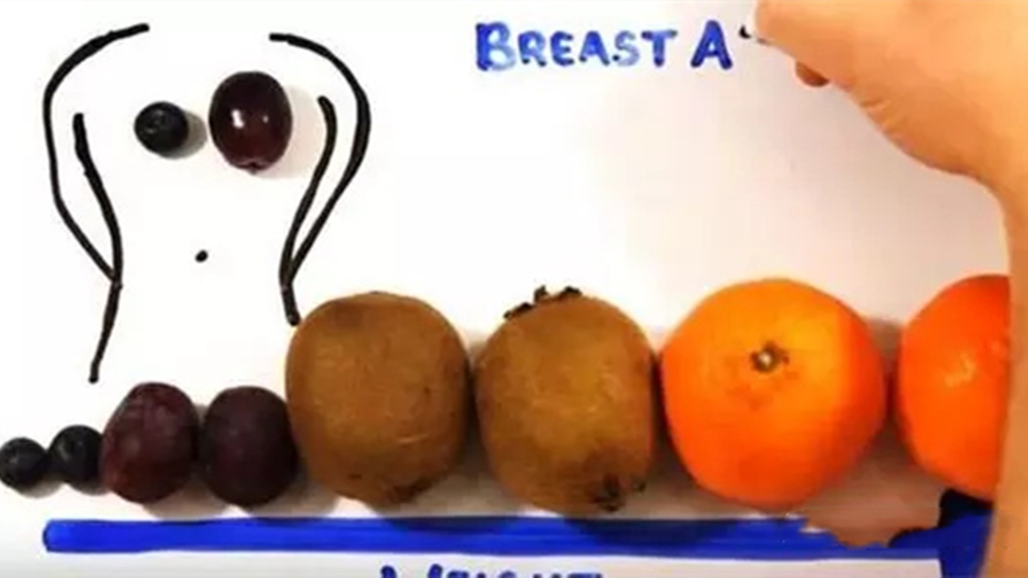 乳房两侧奶量不一样如何调整,为什么两侧乳房产奶不一样