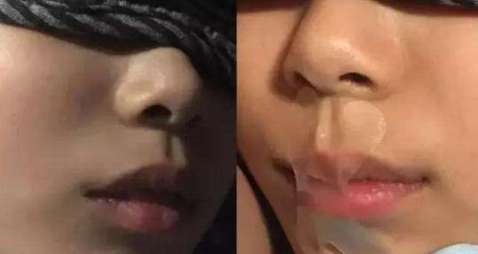 孩子张嘴睡觉用胶带封嘴,儿童张嘴呼吸把嘴粘上有效果吗