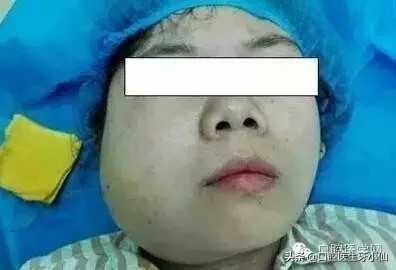 新冠期间智齿发炎肿痛怎么办,新冠期间智齿肿痛吃啥药