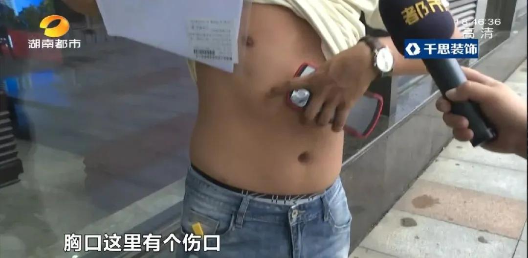 长沙29岁小伙接受5项整形，术后头皮坏死致大面积脱发！《民法典》侵权责任编：须告知医疗风险并征得同意