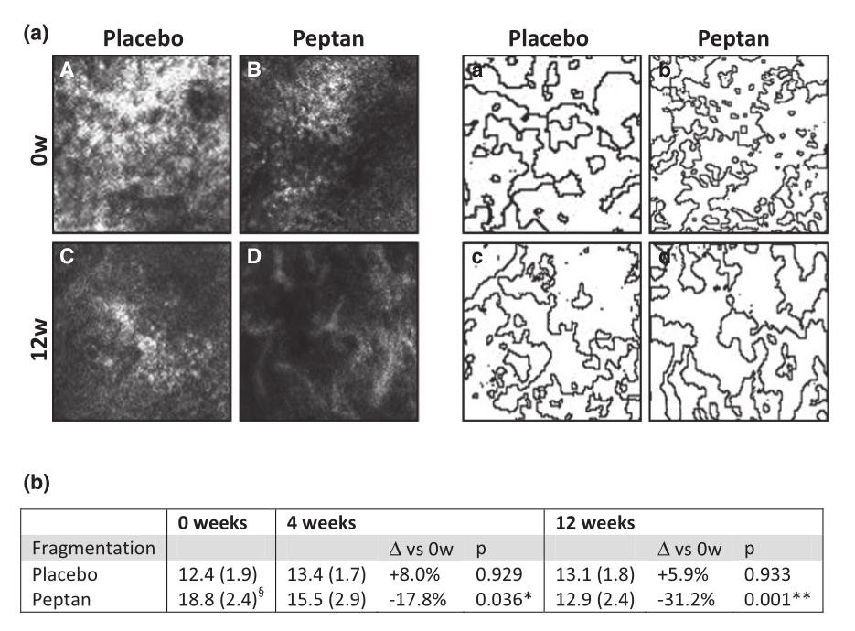 小分子胶原蛋白肽粉是不是智商税,胶原蛋白肽的作用是智商税吗