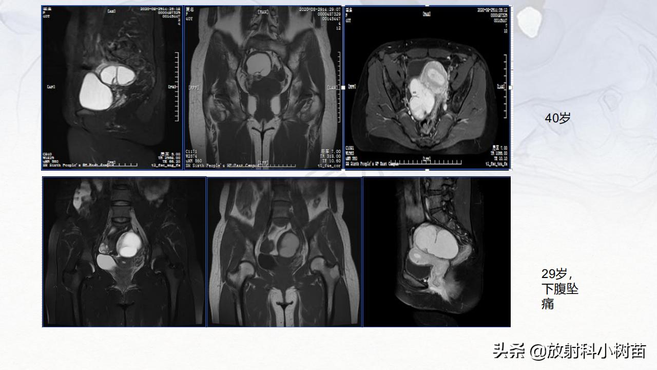 女性盆腔mri解剖图谱,泌尿生殖系统x线解剖
