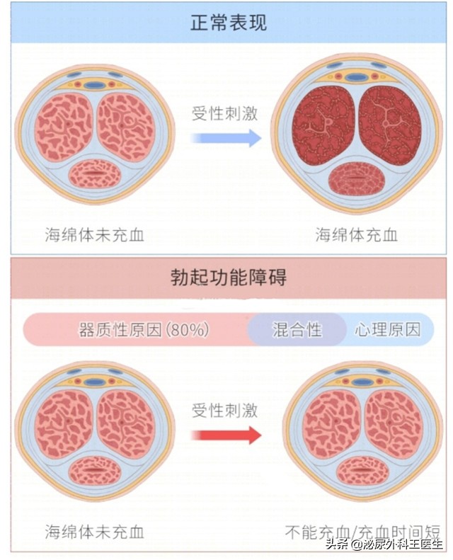 治疗男性ed的维生素是什么,粥样动脉硬化补充维生素c