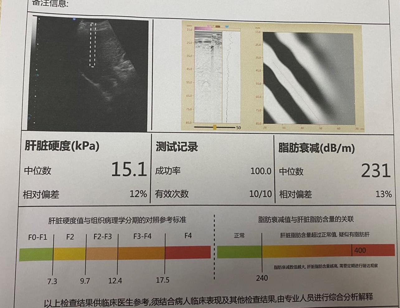 乙肝肝功能正常要不要吃保肝药,有乙肝长期上夜班怎么保肝护肝