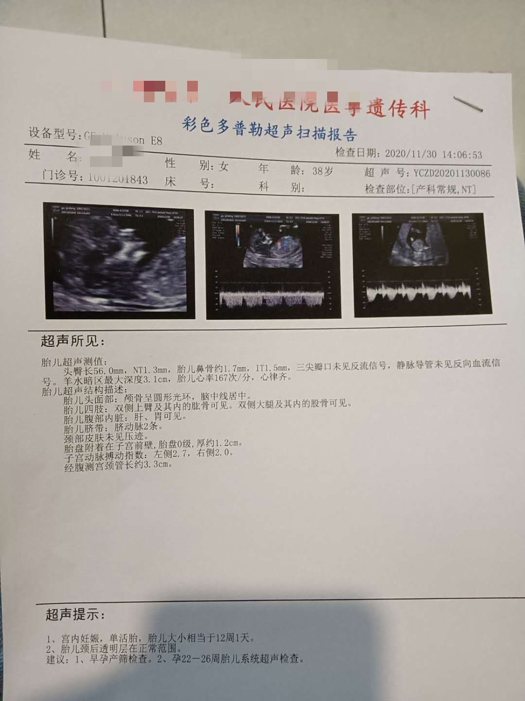 孕检避免哪些坑,产检各种问题