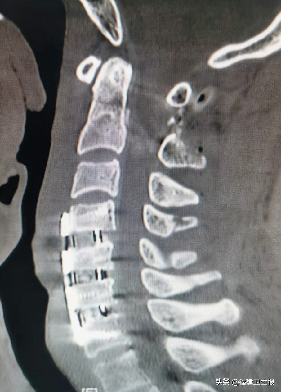 娉夊窞绗竴鍖婚櫌棰堟鎵嬫湳,娉夊窞鍖婚櫌棰堟寰垱