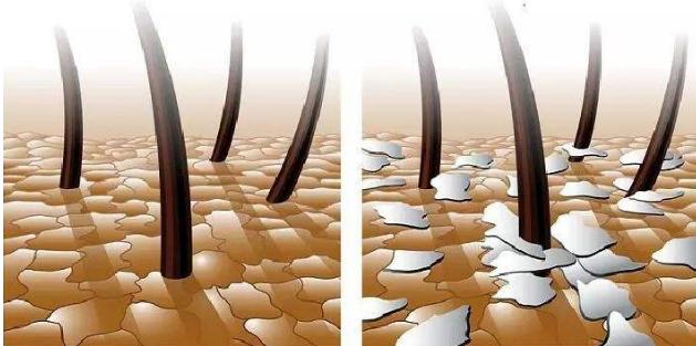 沙宣洗发水为什么头发油油的,沙宣洗发水非常的软塌