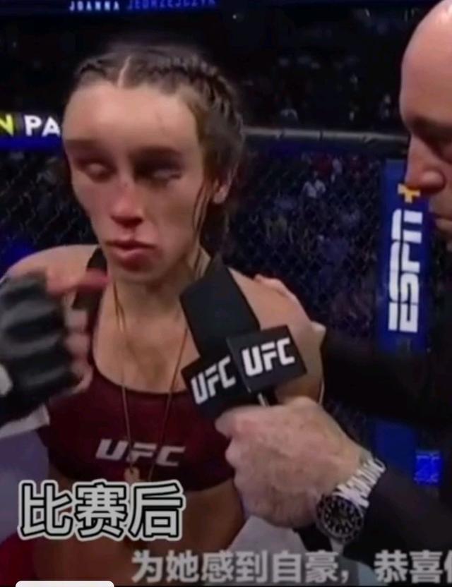 张伟丽为什么赢一次就冠军了,张伟丽为什么这么快能打冠军