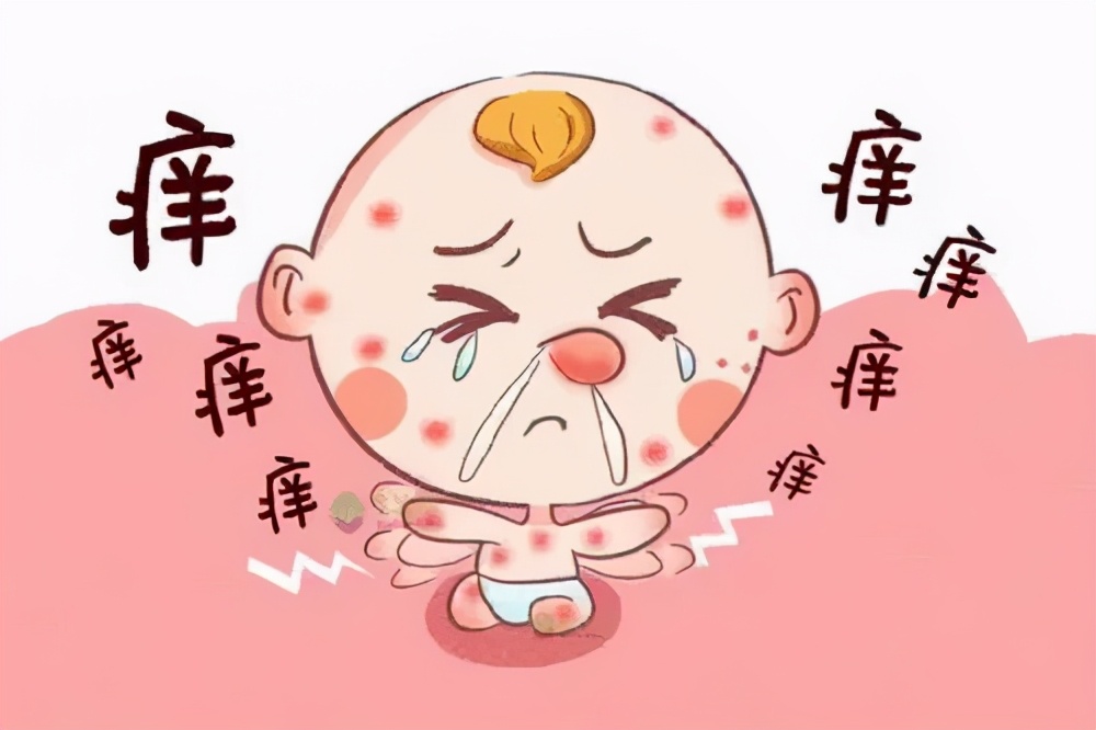 小孩牛奶鸡蛋过敏怎么补蛋白质,对鸡蛋牛奶过敏有什么治疗方法