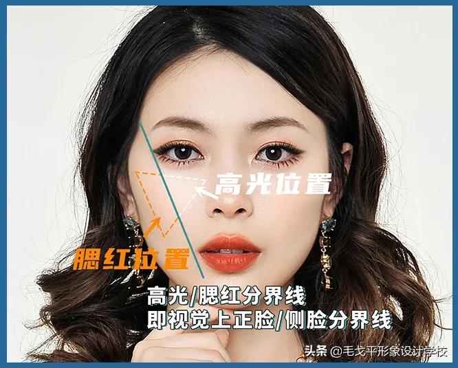 太阳穴凹陷颧骨突出怎么整容,颧骨外扩太阳穴凹陷整容