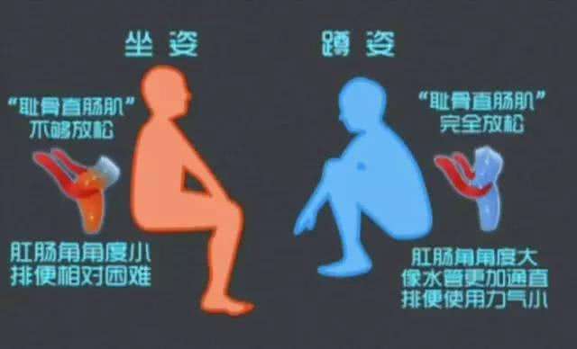 孕期如厕最好的姿势,学习正确如厕的方法