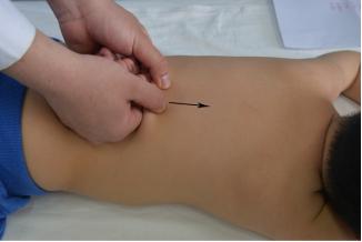 济宁推拿小儿斜颈,医院小儿推拿夜间门诊