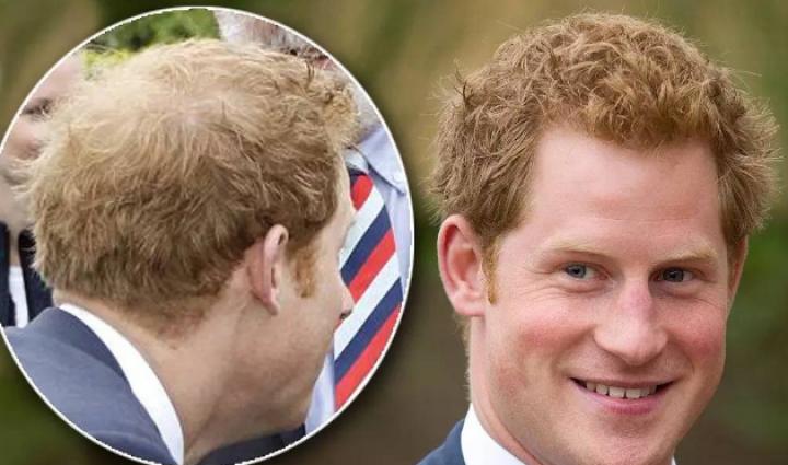 贝克汉姆秃了头,贝克汉姆秃了视频