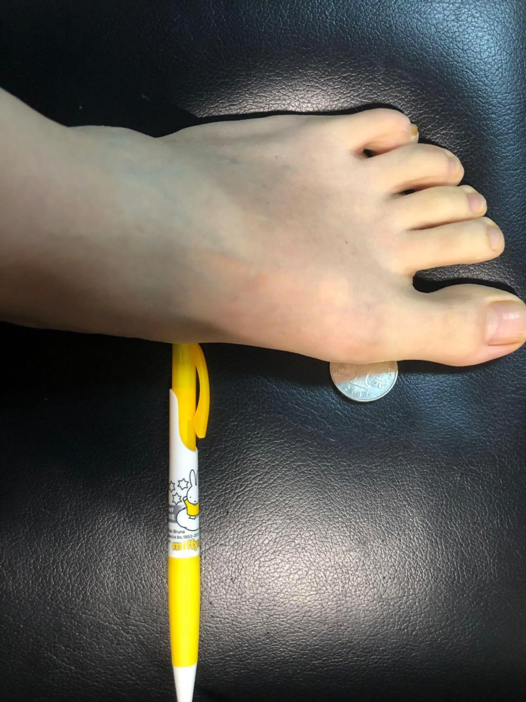 改善扁平足o型腿的训练方法,扁平足导致的膝超伸怎么改善