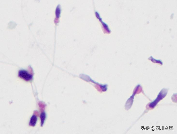 精子是如何产生的百科,精子是不是每天都能生成