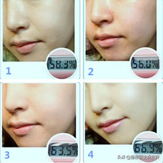 打水光针跟一般的会有什么不一样,水光针补水打完大概会有什么效果