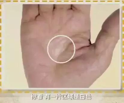 手诊10种常见病从手上就能看出来,如何辨别手掌的健康