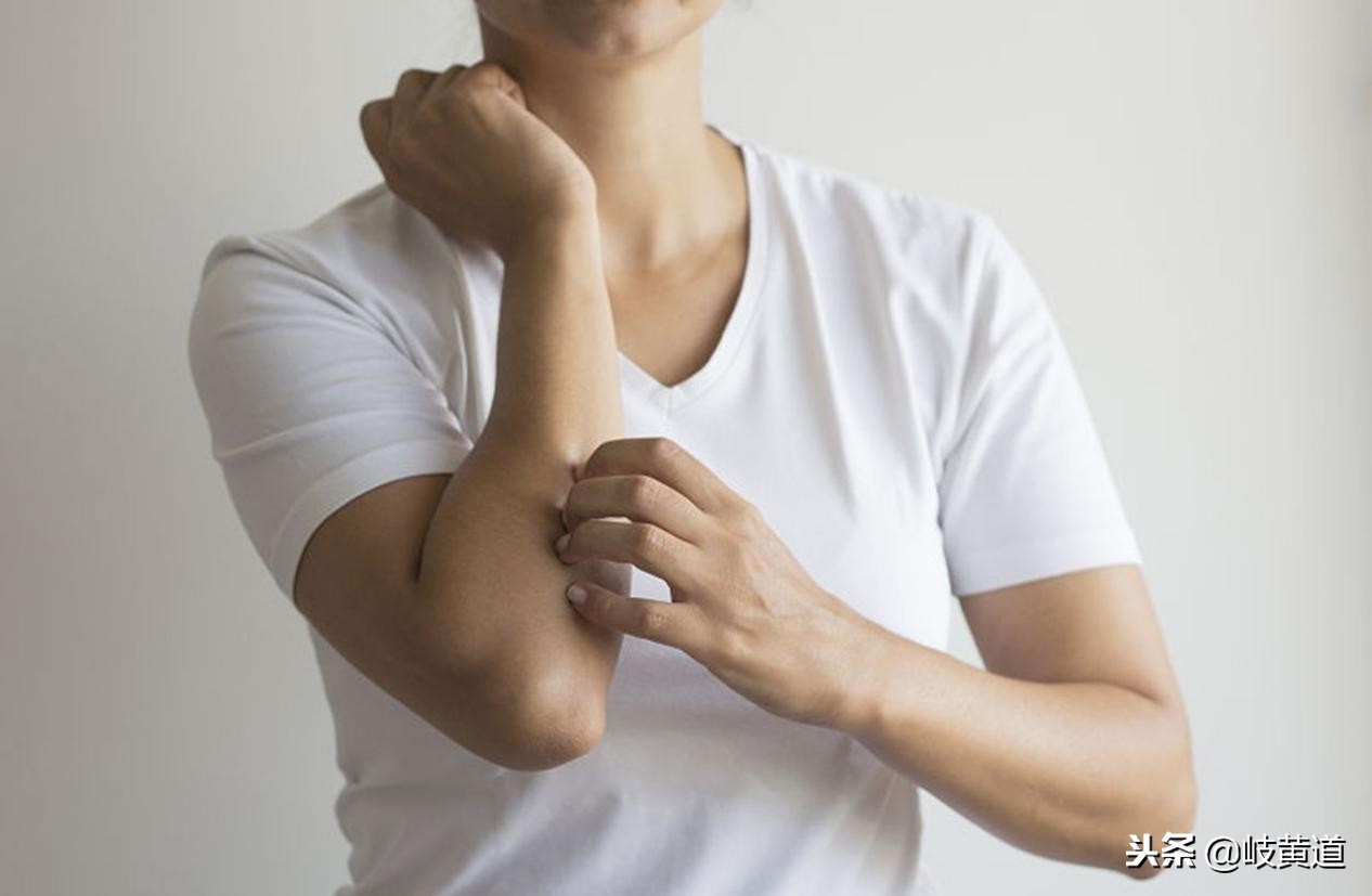 湿疹反反复复能不能完全治好,湿疹反复发作应注意四点