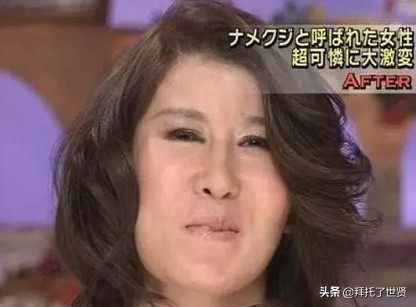 石原里美和佐藤健,石原里美整容之路