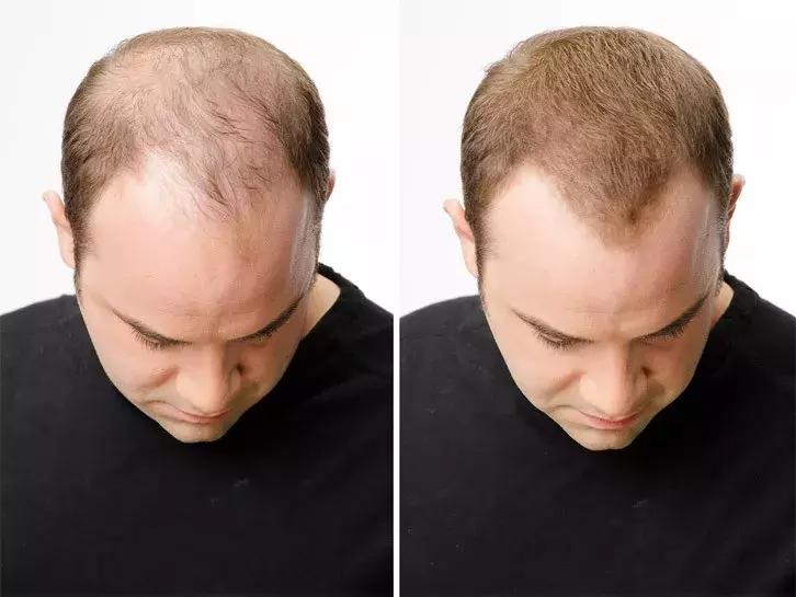 岛国这款生发神器，让你一言不合就长成热带雨林