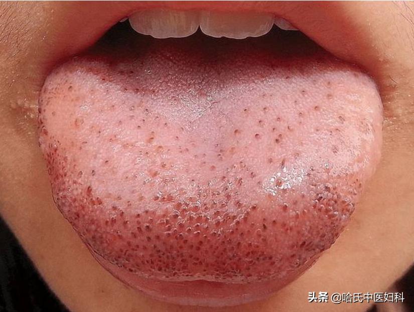 备孕期间如何让卵泡长得更快,卵泡长不大怎么办如何促排卵