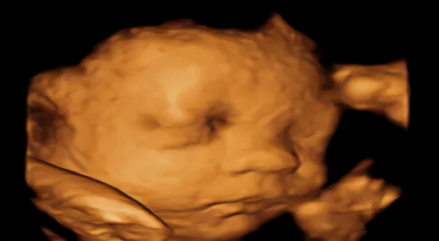 孕期小检查项目,孕期超声检查的那些事