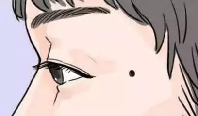 黑痣预防性去除有必要吗,原来去除黑痣是如此简单