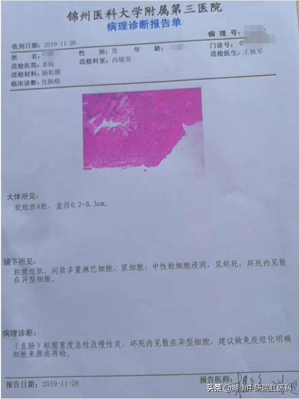 低位直肠癌早期能保肛吗,低位直肠癌晚期治愈吗