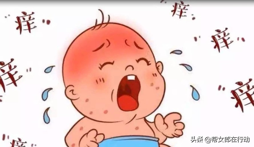 湿疹也有“软肋”！宝宝湿疹怎么办？医生给你支个招
