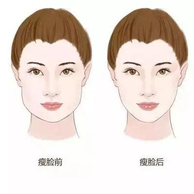 打瘦脸针脸真的瘦吗,打完瘦脸针脸会瘦到什么程度
