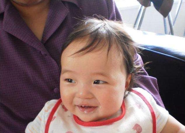 两岁孩子咳嗽厉害有痰久治不愈,12岁娃咳嗽一周成白肺